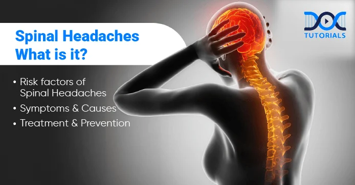 Spinal Headaches: Risks, Symptoms, Causes, Treatment and Prevention